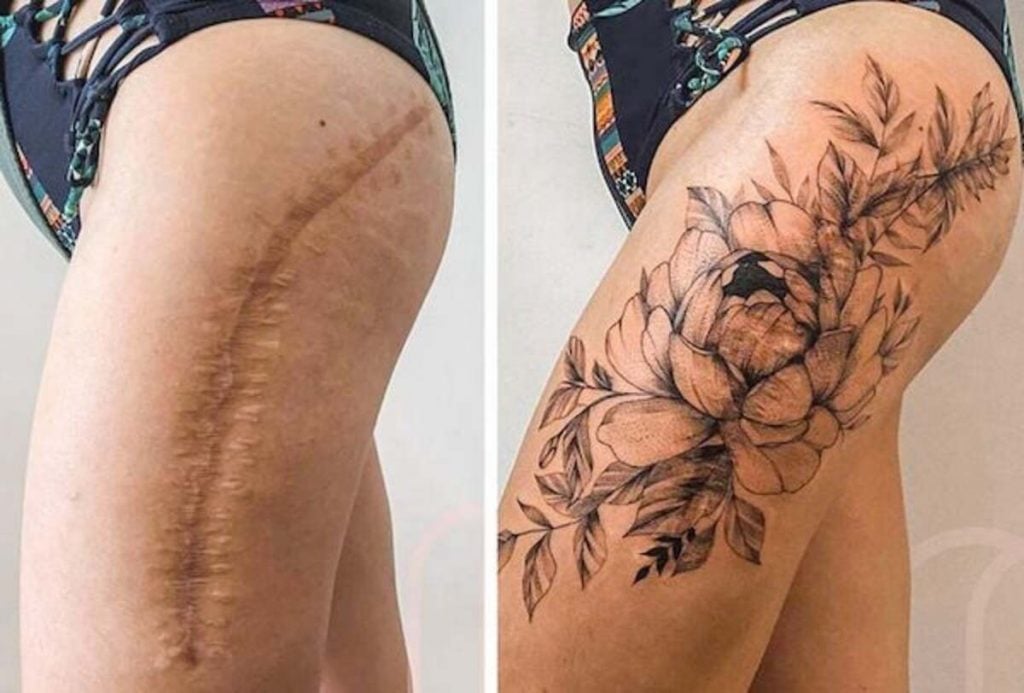 05 Tatouage cicatrice : quand l’art transforme les blessures en beauté