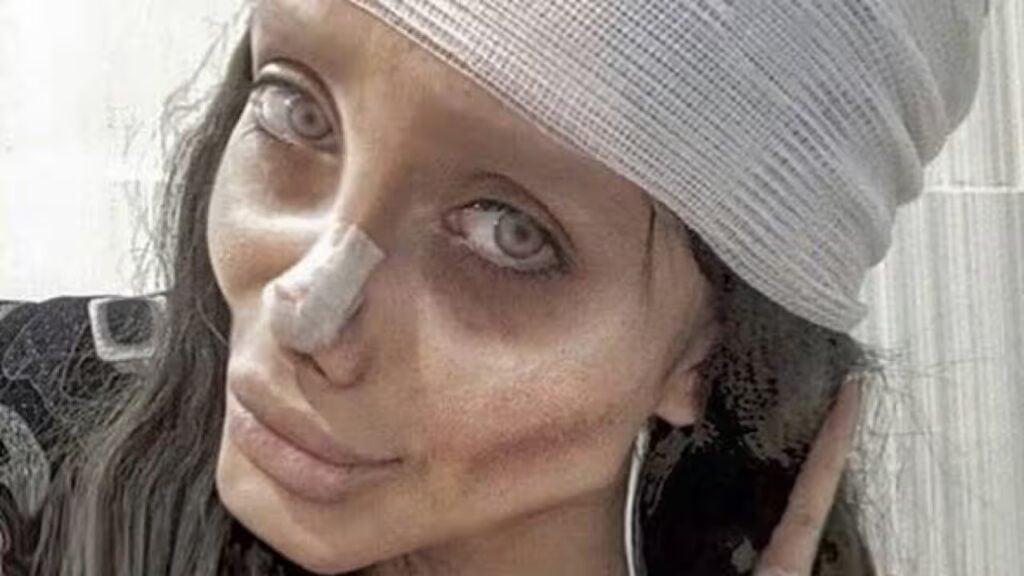 images.sbs .com Le vrai visage du « sosie raté d’Angelina Jolie » : ce que Sahar Tabar a révélé au monde
