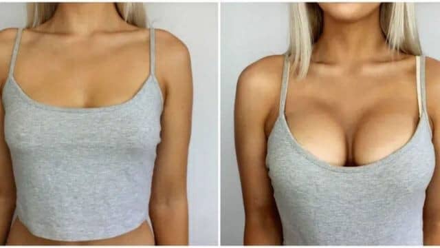 prix augmentation mammaire tunisie 3 Transformation spectaculaire : les photos parlent d’elles-mêmes