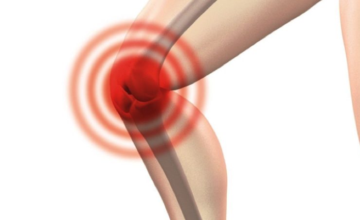 douleur genou Comment soulager la douleur au genou?