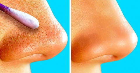 "Guide complet pour retirer les points noirs et soigner la peau du visage : astuces et méthodes efficaces" 1 "Guide complet pour retirer les points noirs et soigner la peau du visage : astuces et méthodes efficaces" pointsnoirs "Guide complet pour retirer les points noirs et soigner la peau du visage : astuces et méthodes efficaces"