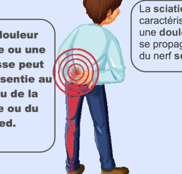 Comment soulager la douleur du nerf sciatique ? Astuces naturelles pour s'en débarrasser 2 Comment soulager la douleur du nerf sciatique ? Astuces naturelles pour s'en débarrasser soulager la douleur du nerf sciatique Comment soulager la douleur du nerf sciatique ? Astuces naturelles pour s'en débarrasser