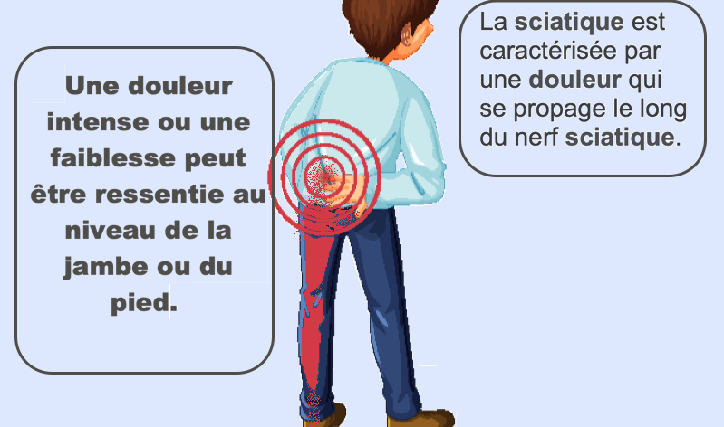 Comment soulager la douleur du nerf sciatique ? Astuces naturelles pour s'en débarrasser 1 Comment soulager la douleur du nerf sciatique ? Astuces naturelles pour s'en débarrasser soulager la douleur du nerf sciatique Comment soulager la douleur du nerf sciatique ? Astuces naturelles pour s'en débarrasser