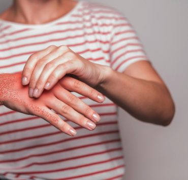 anti iflammatoire naturel Quel est le plus puissant des anti-inflammatoire naturel ?