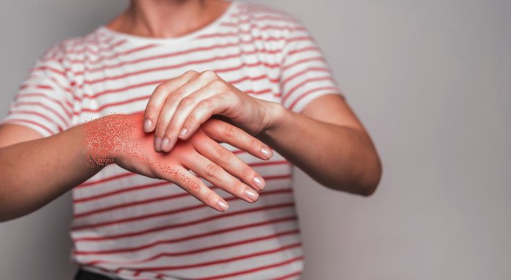 anti iflammatoire naturel Quel est le plus puissant des anti-inflammatoire naturel ?