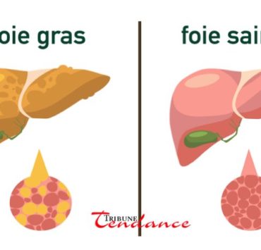 Comment nettoyer mon foie rapidement ? 2 Comment nettoyer mon foie rapidement ? comment nettoyer foie rap tribune tendance Comment nettoyer mon foie rapidement ?