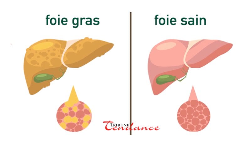 Comment nettoyer mon foie rapidement ? 1 Comment nettoyer mon foie rapidement ? comment nettoyer foie rap tribune tendance Comment nettoyer mon foie rapidement ?