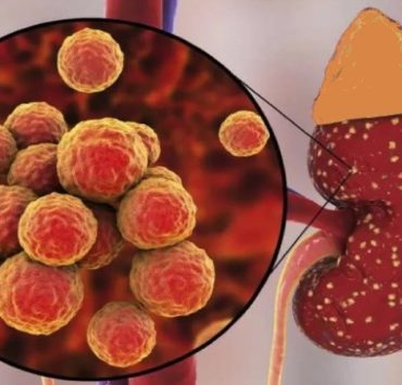 signe probleme avec le rein Quels sont les signes que les reins ne fonctionnent pas bien ?