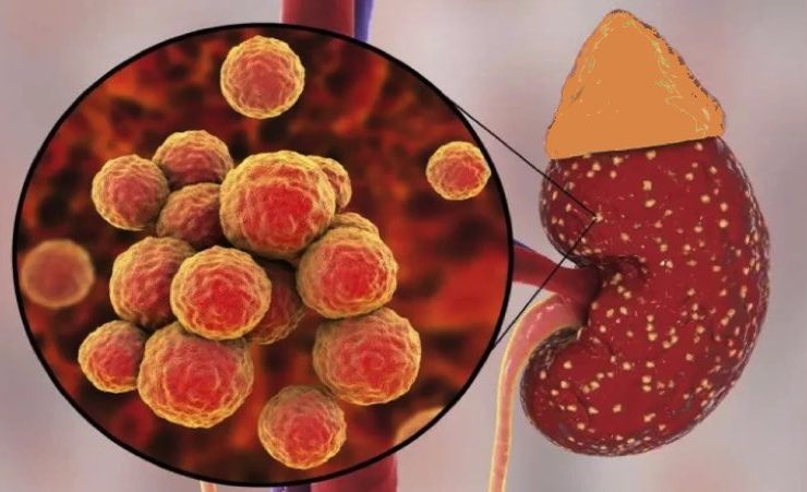 signe probleme avec le rein Quels sont les signes que les reins ne fonctionnent pas bien ?