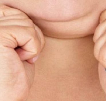 Comment perdre du double menton très rapidement ? 9 astuces à connaître 2 Comment perdre du double menton très rapidement ? 9 astuces à connaître astuce double menton Comment perdre du double menton très rapidement ? 9 astuces à connaître