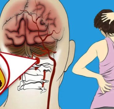 avc signe a savoir Quels sont les signes d'alerte d'un début d'AVC ?