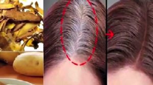 cheveux gris blancs pomme de terre Comment couvrir des cheveux gris naturellement ? 9 astuces méconnues