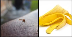 Qu'est-ce qu'on peut faire avec de la peau de banane ? Découvrez 13 Astuces Ingénieuses ! 11 Qu'est-ce qu'on peut faire avec de la peau de banane ? Découvrez 13 Astuces Ingénieuses ! piquure moustique Qu'est-ce qu'on peut faire avec de la peau de banane ? Découvrez 13 Astuces Ingénieuses !