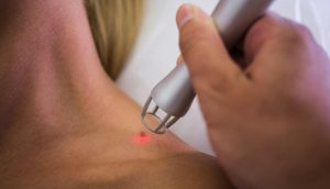 Qu'est-ce qu'on peut faire avec de la peau de banane ? Découvrez 13 Astuces Ingénieuses ! 10 Qu'est-ce qu'on peut faire avec de la peau de banane ? Découvrez 13 Astuces Ingénieuses ! quel produit pour verrue efficace quoi Qu'est-ce qu'on peut faire avec de la peau de banane ? Découvrez 13 Astuces Ingénieuses !