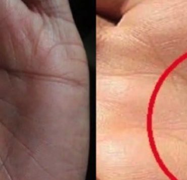 signification du x dans les deux mains astuce Seulement 3% des gens ont la lettre X sur leurs deux mains, mais quelle est sa signification pour leur destin ?