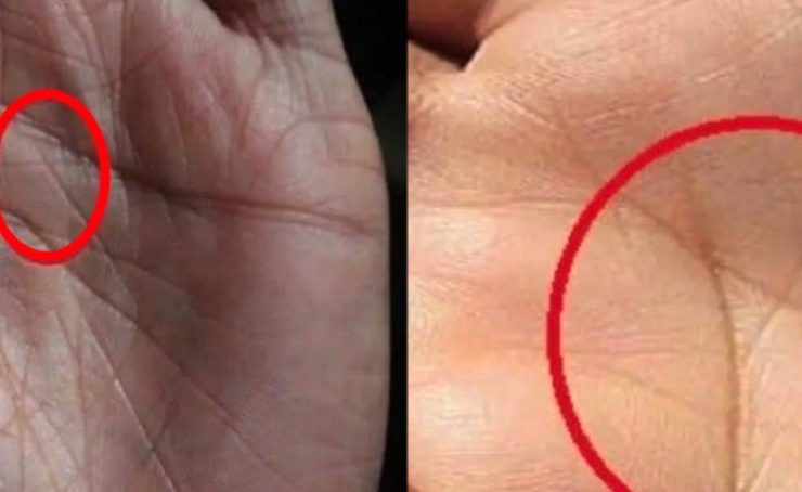 signification du x dans les deux mains astuce Seulement 3% des gens ont la lettre X sur leurs deux mains, mais quelle est sa signification pour leur destin ?