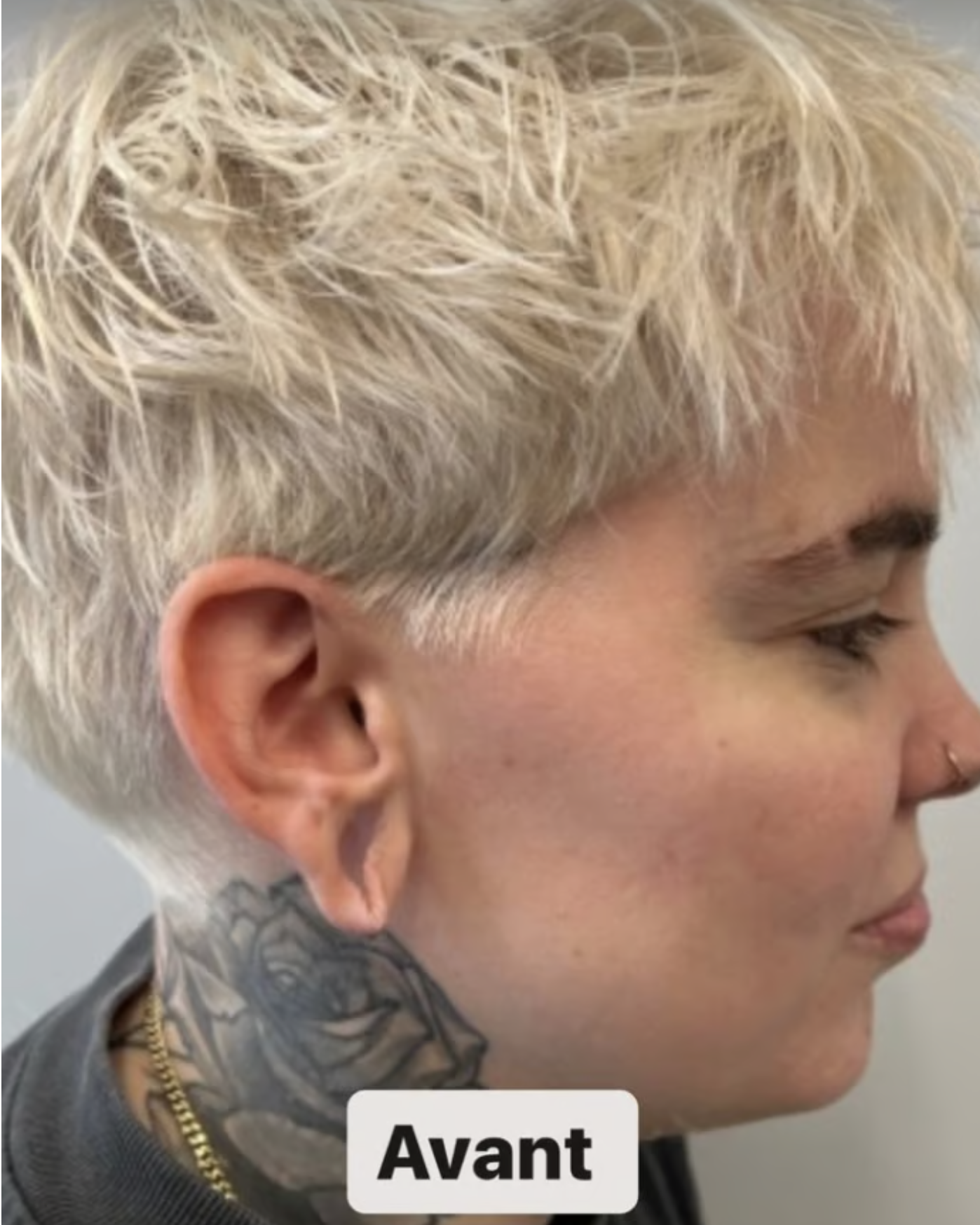 Capture decran le 2024 05 30 a 08.57.30 Roxane Bruneau dévoile les résultats de son opération chirurgicale des oreilles