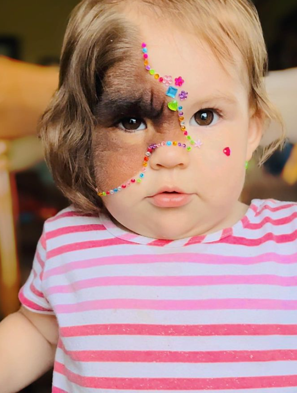 La Mère de Cette Petite Fille a Refusé de Retirer Sa Tache de Naissance Malgré les Commentaires Malveillants 3 La Mère de Cette Petite Fille a Refusé de Retirer Sa Tache de Naissance Malgré les Commentaires Malveillants Capture decran 2024 06 29 071151 La Mère de Cette Petite Fille a Refusé de Retirer Sa Tache de Naissance Malgré les Commentaires Malveillants