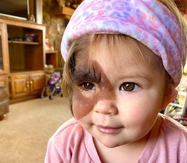 La Mère de Cette Petite Fille a Refusé de Retirer Sa Tache de Naissance Malgré les Commentaires Malveillants 4 La Mère de Cette Petite Fille a Refusé de Retirer Sa Tache de Naissance Malgré les Commentaires Malveillants Capture decran 2024 06 29 071329 La Mère de Cette Petite Fille a Refusé de Retirer Sa Tache de Naissance Malgré les Commentaires Malveillants