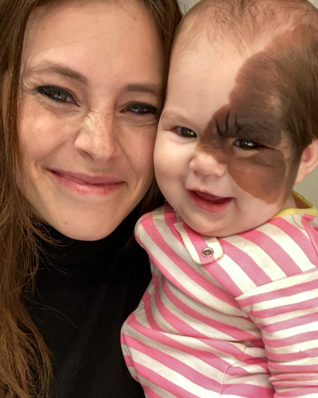 La Mère de Cette Petite Fille a Refusé de Retirer Sa Tache de Naissance Malgré les Commentaires Malveillants 2 La Mère de Cette Petite Fille a Refusé de Retirer Sa Tache de Naissance Malgré les Commentaires Malveillants Capture decran 2024 06 29 071525 La Mère de Cette Petite Fille a Refusé de Retirer Sa Tache de Naissance Malgré les Commentaires Malveillants