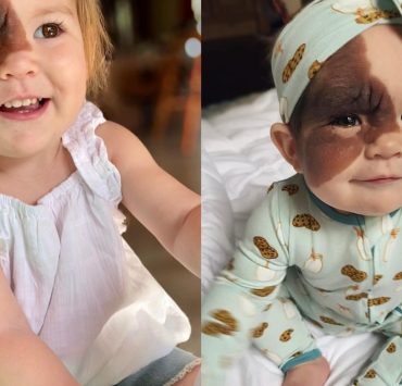 La Mère de Cette Petite Fille a Refusé de Retirer Sa Tache de Naissance Malgré les Commentaires Malveillants 3 La Mère de Cette Petite Fille a Refusé de Retirer Sa Tache de Naissance Malgré les Commentaires Malveillants Design sans titre 48 La Mère de Cette Petite Fille a Refusé de Retirer Sa Tache de Naissance Malgré les Commentaires Malveillants