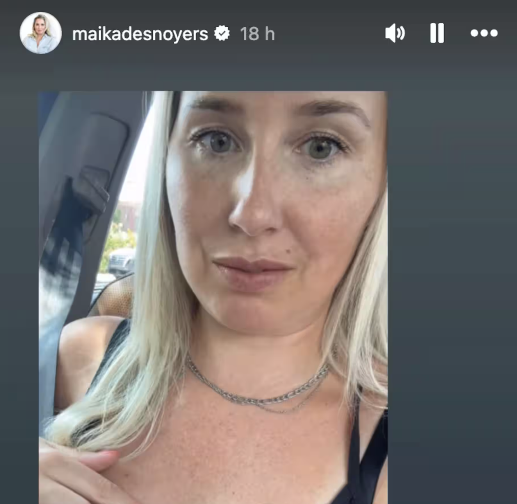 Capture decran le 2024 07 31 a 12.21.11 Choc pour Maïka Desnoyers : sa visite chez le dermatologue lui coûte une fortune!