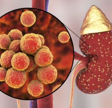 10 signes qui montrent que vos reins ne fonctionnent pas bien 2 10 signes qui montrent que vos reins ne fonctionnent pas bien Screenshot 2024 10 29 08.48.53 10 signes qui montrent que vos reins ne fonctionnent pas bien