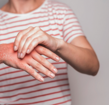 Capture decran 2024 11 28 132812 Quel est le plus efficace des anti-inflammatoires naturels ?