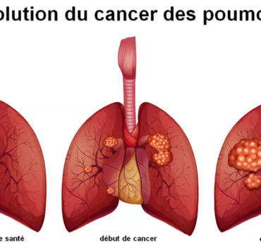 Capture decran 2025 01 16 132420 Vous devez impérativement prêter attention à ce symptôme souvent ignoré, alertent les experts