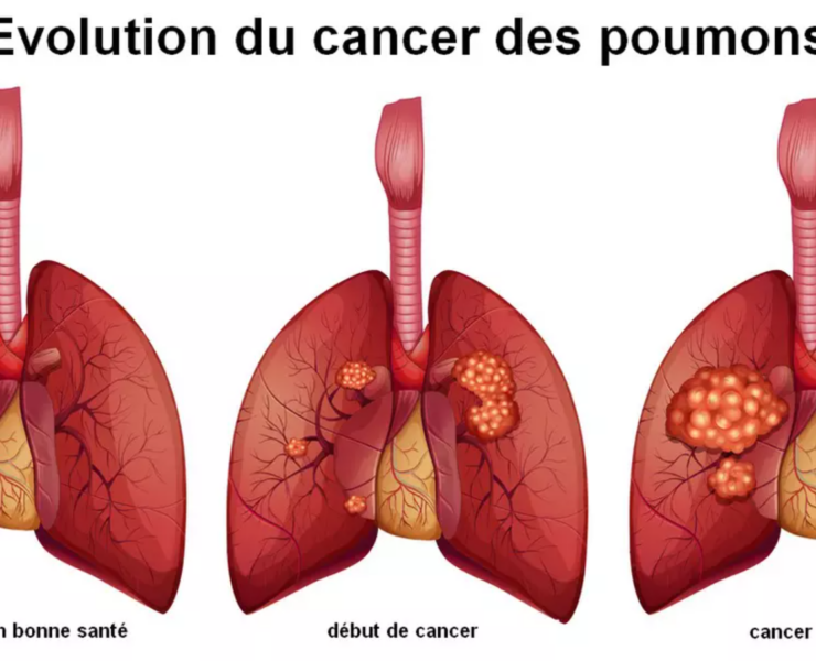 Capture decran 2025 01 16 132420 Vous devez impérativement prêter attention à ce symptôme souvent ignoré, alertent les experts