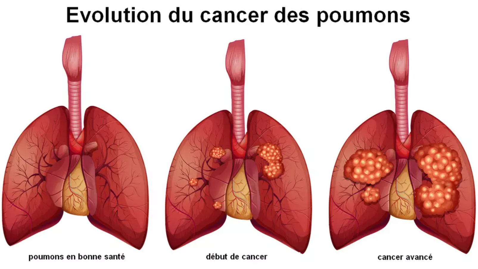 Capture decran 2025 01 16 132420 Vous devez impérativement prêter attention à ce symptôme souvent ignoré, alertent les experts