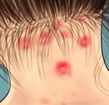 Capture decran 2025 01 22 094629 10 Symptômes de la fibromyalgie, que toute personne souffrant de douleurs musculaires devrait lire