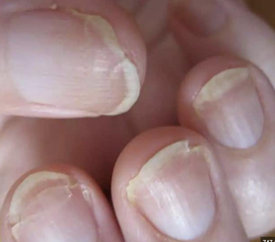 Capture decran le 2025 02 25 a 11.04.10 Ongles cassants ? Voici comment les faire pousser plus vite et plus forts !