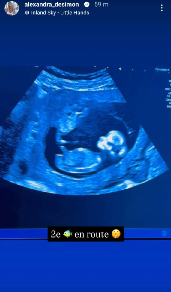 La blonde de Mathieu Baron annonce qu’elle est enceinte de son 2e enfant 2 La blonde de Mathieu Baron annonce qu’elle est enceinte de son 2e enfant Capture decran 2025 04 01 153534 La blonde de Mathieu Baron annonce qu’elle est enceinte de son 2e enfant