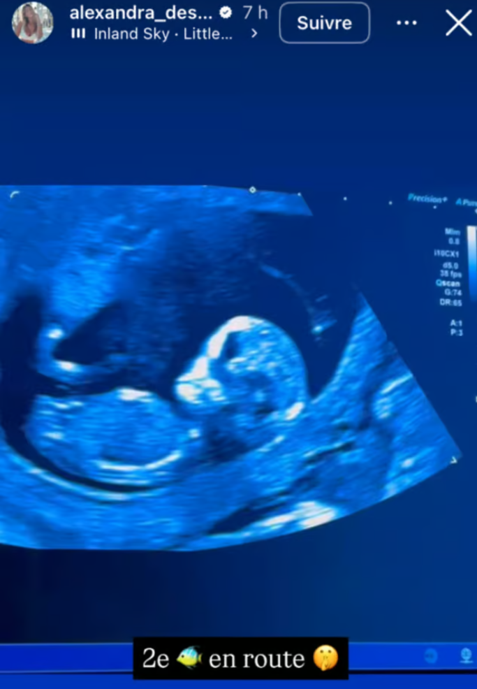 La conjointe de Mathieu Baron confirme enfin la nouvelle qui circulait à leur sujet 3 La conjointe de Mathieu Baron confirme enfin la nouvelle qui circulait à leur sujet Capture decran 2025 04 10 175204 La conjointe de Mathieu Baron confirme enfin la nouvelle qui circulait à leur sujet