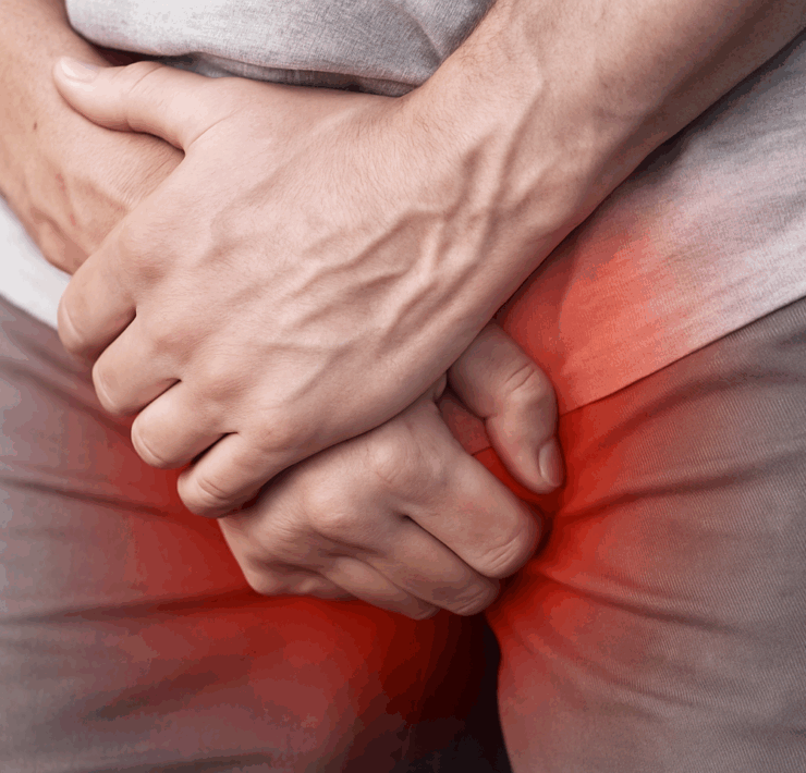 prodtste e1745447514559 Cette habitude que font beaucoup d&rsquo;hommes augmente le risque de cancer de la prostate de 45 %