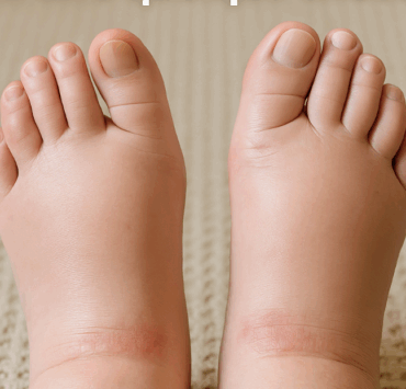 Des pieds qui gonflent peuvent en dire long sur ta santé… 5 Des pieds qui gonflent peuvent en dire long sur ta santé… Capture decran le 2025 05 20 a 09.22.23 e1747748033404 Des pieds qui gonflent peuvent en dire long sur ta santé…