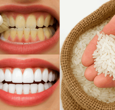 dentsb e1747845866191 Blanchir ses dents en 1 minute : le secret que les dentistes préfèrent taire