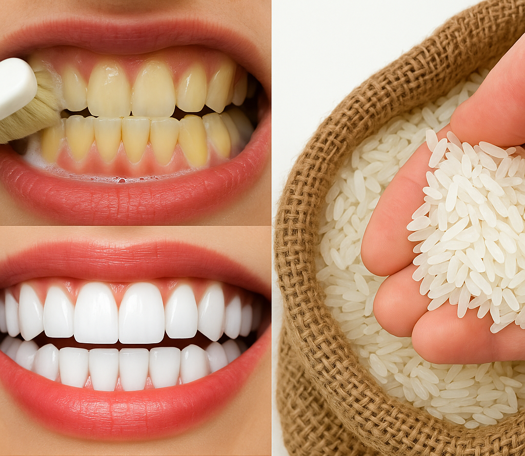Blanchir ses dents en 1 minute : le secret que les dentistes préfèrent taire 1 Blanchir ses dents en 1 minute : le secret que les dentistes préfèrent taire dentsb e1747845866191 Blanchir ses dents en 1 minute : le secret que les dentistes préfèrent taire