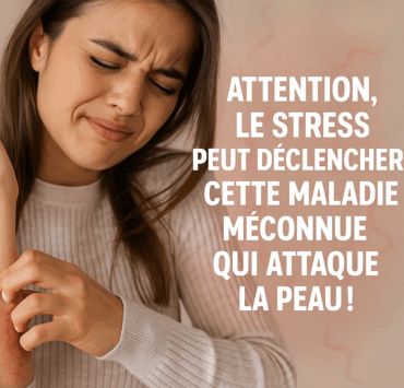 Stress et Peau : Découvrez la Maladie Cachée Qui Frappe Après 50 Ans 4 Stress et Peau : Découvrez la Maladie Cachée Qui Frappe Après 50 Ans stress virus Stress et Peau : Découvrez la Maladie Cachée Qui Frappe Après 50 Ans