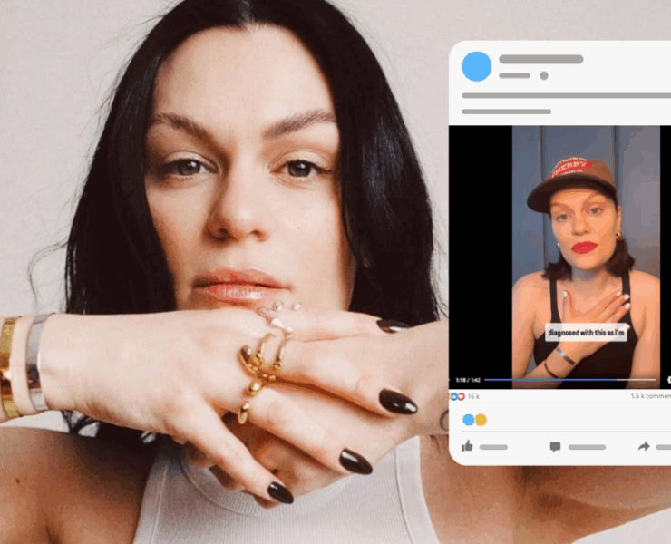 Capture decran 2025 06 04 184845 « Je vais disparaître un moment » : Jessie J annonce son combat contre le cancer