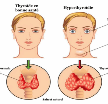 Capture decran 2025 06 06 003730 Ce test de 60 secondes peut révéler si votre thyroïde fonctionne bien – à essayer dès maintenant !