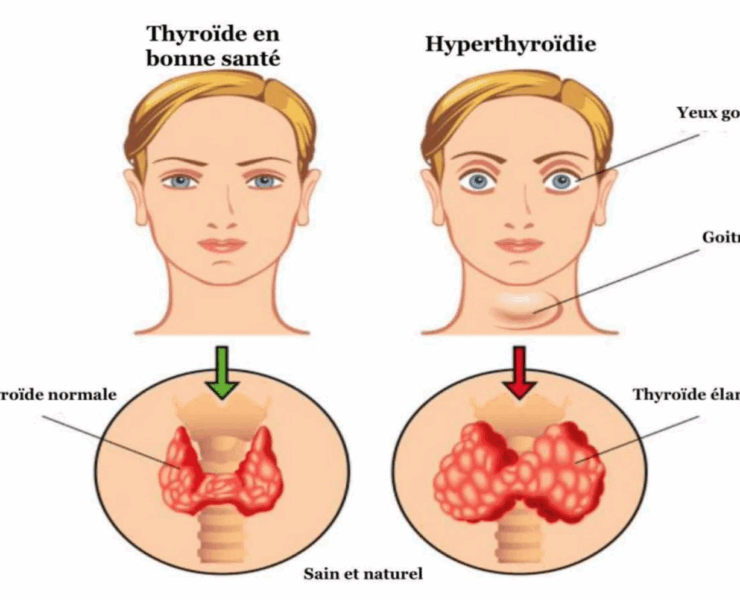 Capture decran 2025 06 06 003730 Ce test de 60 secondes peut révéler si votre thyroïde fonctionne bien – à essayer dès maintenant !