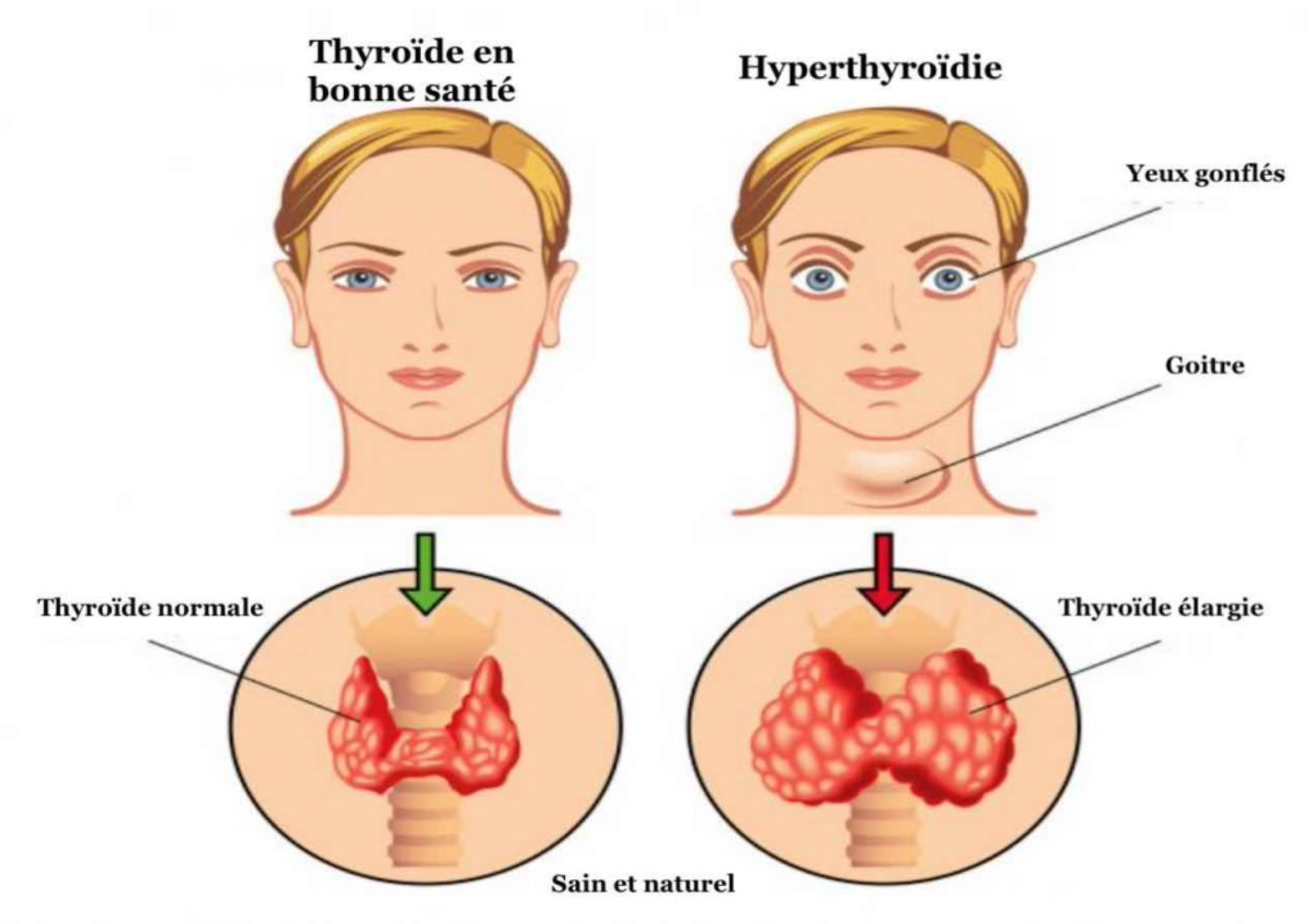 Ce test de 60 secondes peut révéler si votre thyroïde fonctionne bien – à essayer dès maintenant ! 1 Ce test de 60 secondes peut révéler si votre thyroïde fonctionne bien – à essayer dès maintenant ! Capture decran 2025 06 06 003730 Ce test de 60 secondes peut révéler si votre thyroïde fonctionne bien – à essayer dès maintenant !