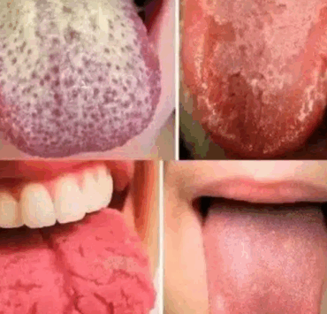 Capture decran 2025 06 21 042643 Santé buccale : 4 signes sur votre langue à ne jamais ignorer