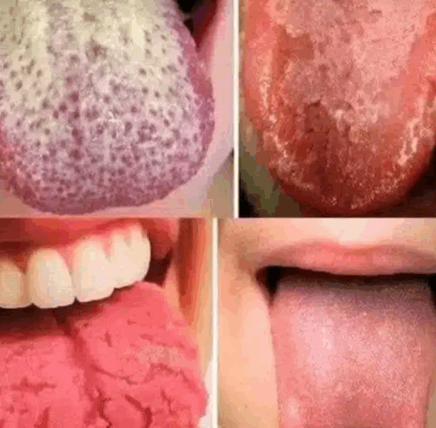 Capture decran 2025 06 21 042643 Santé buccale : 4 signes sur votre langue à ne jamais ignorer