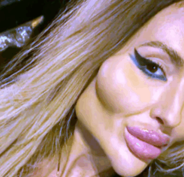 La femme aux plus grandes pommettes du monde choque encore : elle passe une nouvelle fois sous les aiguilles ! (VIDÉO) 4 La femme aux plus grandes pommettes du monde choque encore : elle passe une nouvelle fois sous les aiguilles ! (VIDÉO) Capture decran 2025 06 30 045738 La femme aux plus grandes pommettes du monde choque encore : elle passe une nouvelle fois sous les aiguilles ! (VIDÉO)