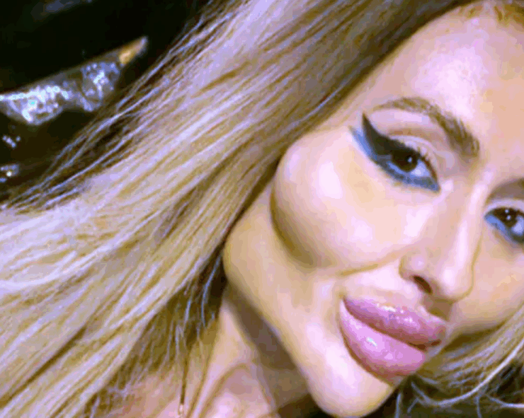 Capture decran 2025 06 30 045738 La femme aux plus grandes pommettes du monde choque encore : elle passe une nouvelle fois sous les aiguilles ! (VIDÉO)