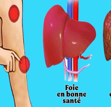 Capture decran 2025 07 05 052607 Oui, le corps prévient lorsque le foie va mal : 5 symptômes à identifier