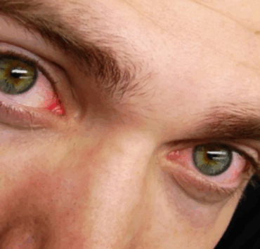 Pourquoi faut-il dormir au moins 6 heures par nuit ? 3 Pourquoi faut-il dormir au moins 6 heures par nuit ? Capture decran 2025 07 09 050019 Pourquoi faut-il dormir au moins 6 heures par nuit ?